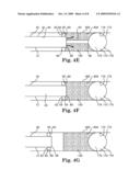 METHOD, APPARATUS AND KITS FOR FORMING STRUCTURAL MEMBERS WITHIN THE CARDIAC VENOUS SYSTEM diagram and image