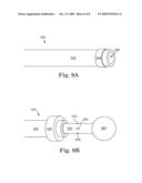 METHOD, APPARATUS AND KITS FOR FORMING STRUCTURAL MEMBERS WITHIN THE CARDIAC VENOUS SYSTEM diagram and image