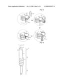 Reamer for Operating Implant diagram and image