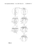 Reamer for Operating Implant diagram and image