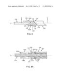 ARTERIOTOMY STAPLING SYSTEM FOR NON-ORTHOGONAL TISSUE TRACKS AND METHODS OF USE THEREIN diagram and image