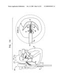 SEGMENTED RING PLACEMENT diagram and image