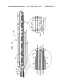 SEGMENTED RING PLACEMENT diagram and image