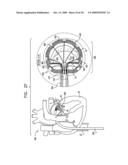 SEGMENTED RING PLACEMENT diagram and image