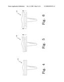ADJUSTABLE, REMOTE-CONTROLLABLE ORTHOPAEDIC PROSTHESIS AND ASSOCIATED METHOD diagram and image