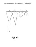 ELECTRODECONTAMINATION OF CONTAMINATED SURFACES diagram and image