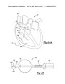 Determining a Material Flow Characteristic in a Structure diagram and image