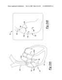 Determining a Material Flow Characteristic in a Structure diagram and image