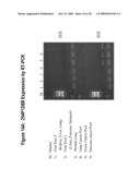 NUCLEIC ACIDS AND CORRESPONDING PROTEINS ENTITLED 254P1D6B USEFUL IN TREATMENT AND DETECTION OF CANCER diagram and image