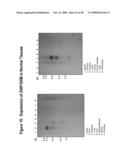 NUCLEIC ACIDS AND CORRESPONDING PROTEINS ENTITLED 254P1D6B USEFUL IN TREATMENT AND DETECTION OF CANCER diagram and image