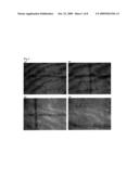 ANTI-ANGIOGENIC COMPOSITION COMPRISING GRAIN-DERIVED COMPONENT AS ACTIVE INGREDIENT diagram and image