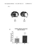 METHOD OF PREVENTING AND TREATING BRAIN INFARCTION diagram and image