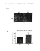 METHOD OF PREVENTING AND TREATING BRAIN INFARCTION diagram and image