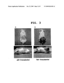 ARTIFICIAL LYMPH NODE FOR TREATING CANCER diagram and image