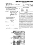 Nanoliposome Using Esterified Lecithin And Method For Preparing The Same, And Composition For Preventing Or Treating Skin Diseases Comprising The Same diagram and image