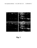 ALZHEIMER S DISEASE BIOMARKERS AND METHODS OF USE diagram and image