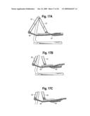 Stride adjustment mechanism diagram and image