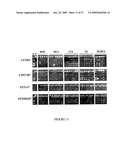 DNA METHYLATION BIOMARKERS IN LYMPHOID AND HEMATOPOIETIC MALIGNANCIES diagram and image