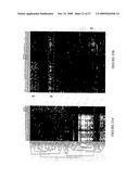 DNA METHYLATION BIOMARKERS IN LYMPHOID AND HEMATOPOIETIC MALIGNANCIES diagram and image