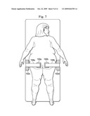 Method and Apparatus for Retention of Adipose Tissue diagram and image