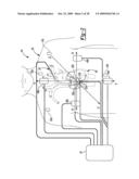 Locating an Introducer diagram and image