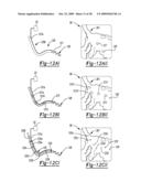 Locating an Introducer diagram and image