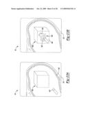 Locating an Introducer diagram and image