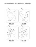 Locating an Introducer diagram and image