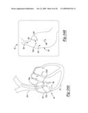 Locating an Introducer diagram and image