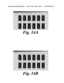 SYSTEM AND METHOD FOR BLADDER DETECTION USING HARMONIC IMAGING diagram and image