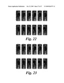 SYSTEM AND METHOD FOR BLADDER DETECTION USING HARMONIC IMAGING diagram and image