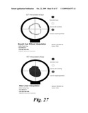 SYSTEM AND METHOD FOR BLADDER DETECTION USING HARMONIC IMAGING diagram and image