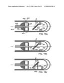 Scanning mechanisms for imaging probe diagram and image