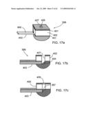 Scanning mechanisms for imaging probe diagram and image