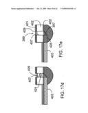 Scanning mechanisms for imaging probe diagram and image