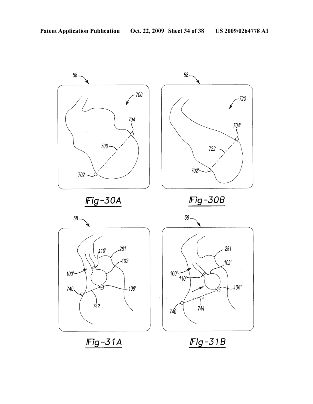 Uni-Polar and Bi-Polar Switchable Tracking System between - diagram, schematic, and image 35