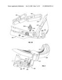 Shoulder ROM Orthosis diagram and image