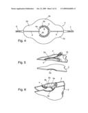 Liquid streaming devices for treating wounds, method of making such devices, and method of using such devices for treating wounds diagram and image