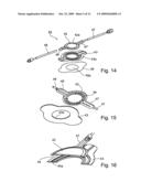 Liquid streaming devices for treating wounds, method of making such devices, and method of using such devices for treating wounds diagram and image