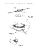 Liquid streaming devices for treating wounds, method of making such devices, and method of using such devices for treating wounds diagram and image