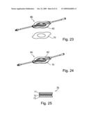 Liquid streaming devices for treating wounds, method of making such devices, and method of using such devices for treating wounds diagram and image