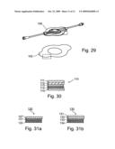 Liquid streaming devices for treating wounds, method of making such devices, and method of using such devices for treating wounds diagram and image