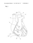 INSERTION ASSISTING TOOL FOR CATHETER, CATHETER ASSEMBLY, AND CATHETER SET diagram and image