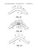 SYSTEM AND METHOD FOR ALTERING INTERNAL STRESS DISTRIBUTIONS TO RESHAPE A MATERIAL diagram and image