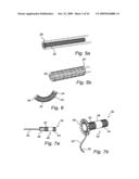 Device, A Kit And A Method For Treatment Of Disorders In The Heart Rhythm Regulation System diagram and image