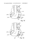 Device, A Kit And A Method For Treatment Of Disorders In The Heart Rhythm Regulation System diagram and image