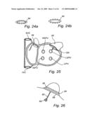 Device, A Kit And A Method For Treatment Of Disorders In The Heart Rhythm Regulation System diagram and image