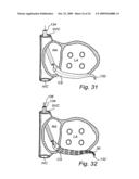 Device, A Kit And A Method For Treatment Of Disorders In The Heart Rhythm Regulation System diagram and image