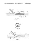 Steerable Endovascular Retrieval Device diagram and image