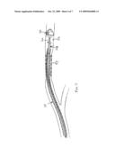 Steerable Endovascular Retrieval Device diagram and image